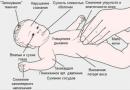 Adrenogenital syndrome - how to identify it and alleviate the course of the disease